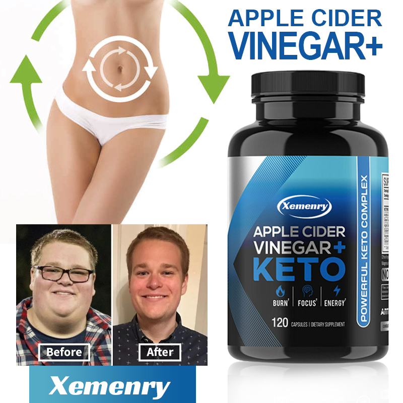 Kapsułka z octem jabłkowym Ket – Apple Cider Vinegar Pill recenzja i cena